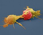 Natürliche Killerzellen attackieren Krebszelle ©eye of science