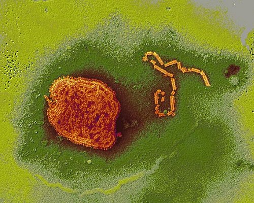 Mumps-Virus mit Erbgutstrang