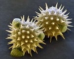 Vergrößerung von Sonnenblumenpollen ©eye of science