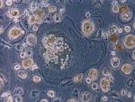 HI-Virus ist in Fresszelle eingedrungen ©eye of science