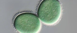 Zwei Blaualgen unter dem Mikroskop