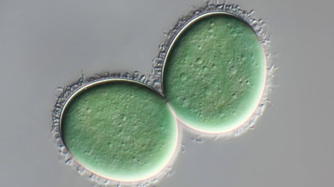 Zwei Blaualgen unter dem Mikroskop
