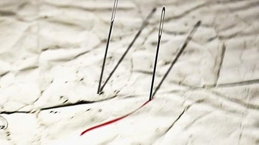 Nadeln (Foto: SWR/Mosaic Films – Screenshot aus der Sendung)