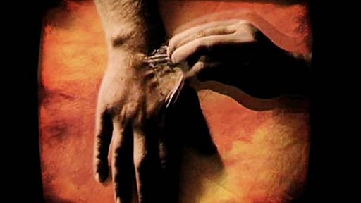 Eine Person zieht sich Haut von der Hand. (Foto: SWR/Mosaic Films – Screenshot aus der Sendung)