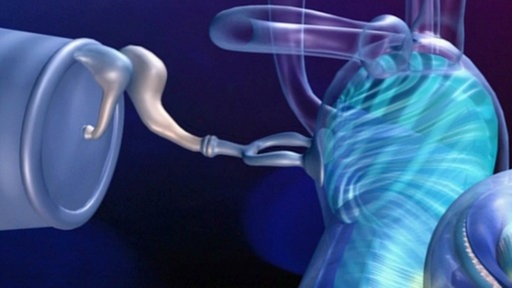 Grafik des Mittelohres mit Trommelfell und den Gehörknöchelchen