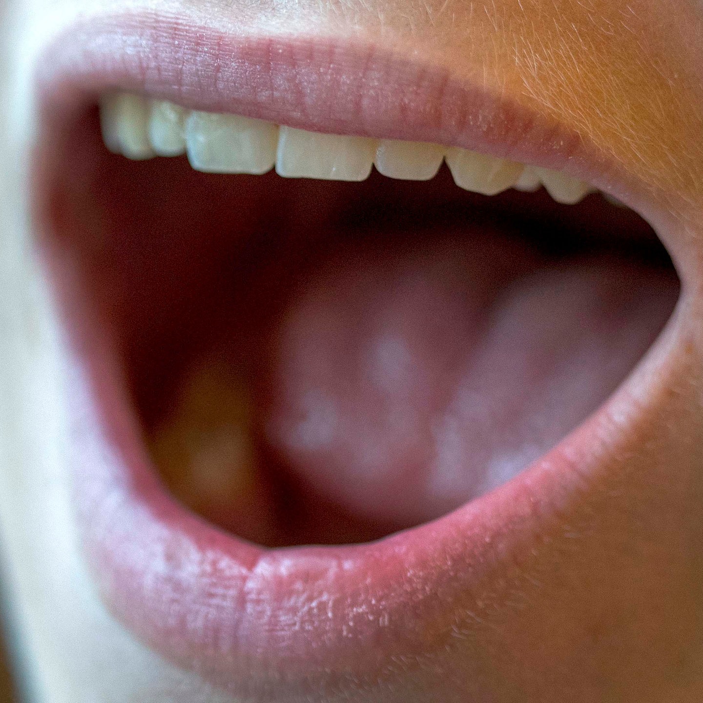 Pubertät: Wie peinlich ist der Stimmbruch? | Podcast für Kinder ...