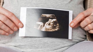 Eine schwangere Frau hält ein Ultraschallbild, das einen Embryo zeigt, vor ihren Bauch