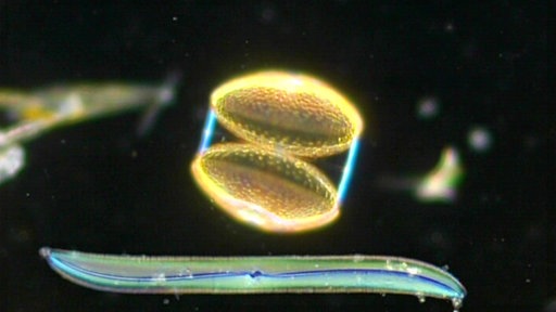 Vor schwarzem Hintergrund sind zwei leuchtend bunte Formen zu sehen: unten im Bild schlangenförmig und bläulich, darüber zwei gelbe runde und leicht bauchige Zellen übereinander, die rechts und links durch einen blauen Strich verbunden sind.