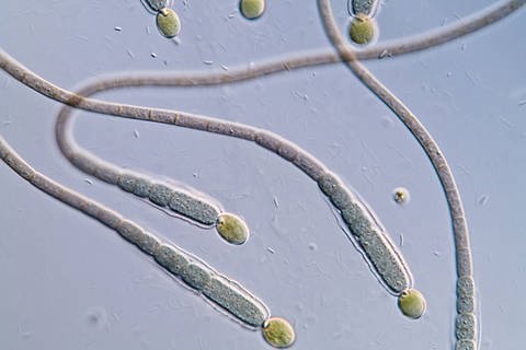 Cyanobakterien (Foto: Imago)