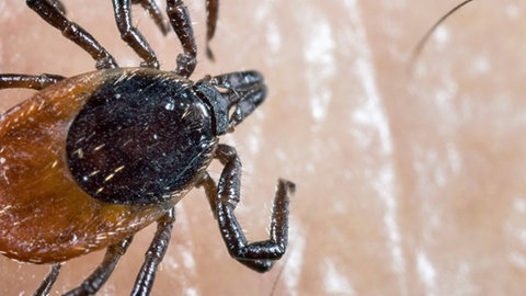 Nahaufnahme einer Zecke auf Haut.