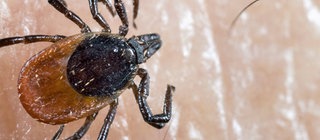 Nahaufnahme einer Zecke auf Haut.