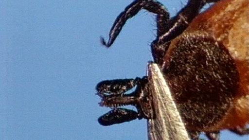 Zeckenentfernung mit Pinzette