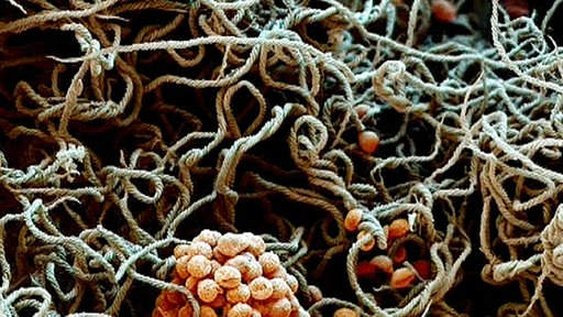 Animation des Inneren der Fruchtkörper.