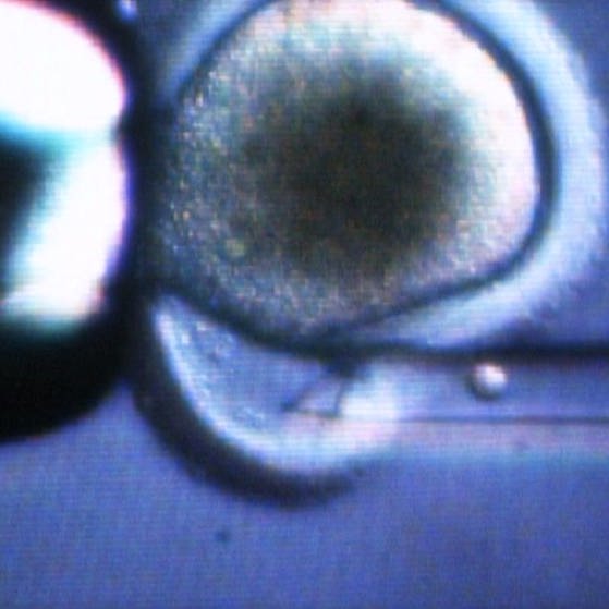 Mikroskopaufnahme. (Foto: SWR – Screenshot aus der Sendung)
