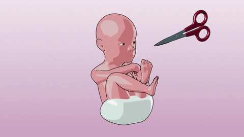 Animation: Baby und Schere.