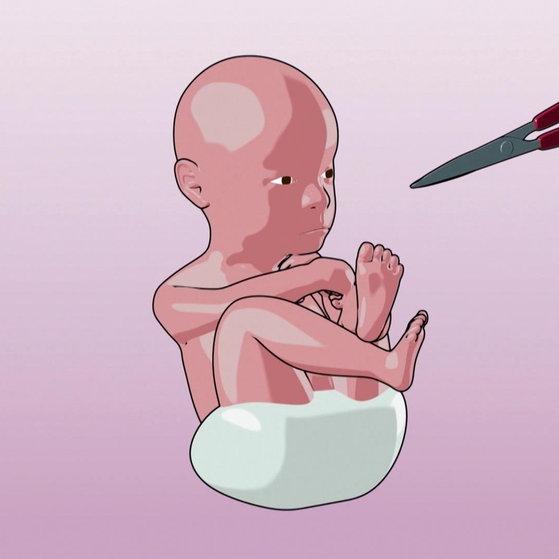 Animation: Baby und Schere.