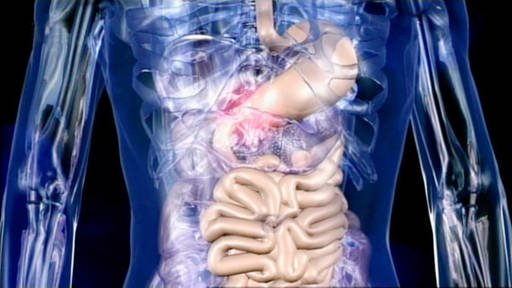 Gläsernes Modell eines menschlichen Rumpfs: Zu sehen sind ein Teil der Speiseröhre, der Magen und der in Schlingen liegende Dünndarm. (Foto: SWR/WDR – Print aus der Sendung)