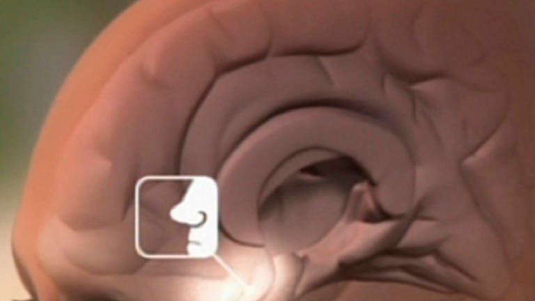 Querschnitt eines Gehirns. (Foto: SWR – Screenshot aus der Sendung)