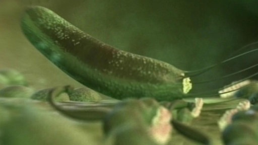 3D-Animation des menschlichen Dickdarms.