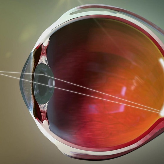 Animation: Funktion der Abbildung beim Linsenauge.