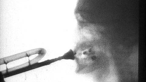 Röntgenaufnahme eines Trompeter (Foto: SWR - Screenshot aus der Sendung)