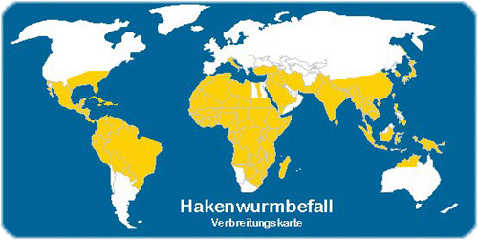 Verbreitungskarte: Hakenwurmbefall