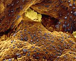 Makroaufnahme der Darmschleimhaut ©eye of science