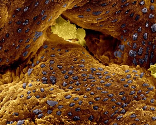 Makroaufnahme der Darmschleimhaut