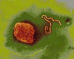 Mumps-Virus ©eye of science