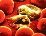 Plasmodien zerstören Blutzellen