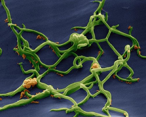 Borrelien