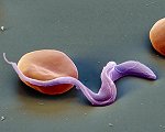 Trypanosom (mit Blutzelle) ©eye of science