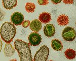 HI viruses  &copy;eye of science