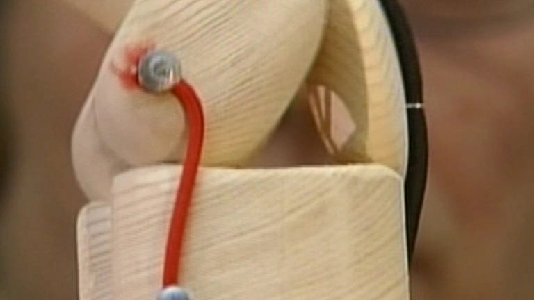Nachbau eines Kniegelenkes (Foto: SWR – Screenshot aus der Sendung)