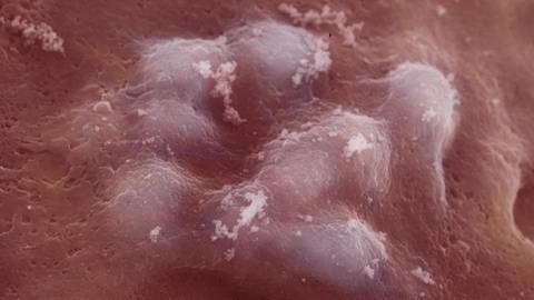 Wie Viren funktionieren – Herpes unter dem Mikroskop (Foto: SWR)