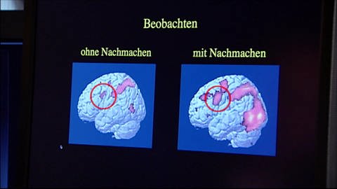 Networks in the brain (Foto: WDR)