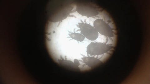 Eine Mikroskopaufnahme von Milben. (Foto: SWR / BR / WDR - Screenshot aus der Sendung)