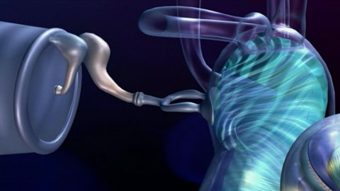 Superohren · total phänomenal