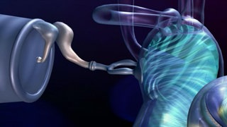 Superohren · total phänomenal