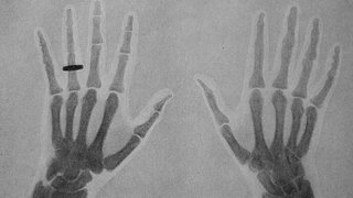 Zwei Hände, einen mit Ring. Strahlen schaffen Durchblick · total phänomenal