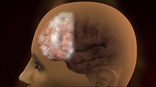 Wie kann man sich Dinge besser merken? · Frage trifft Antwort