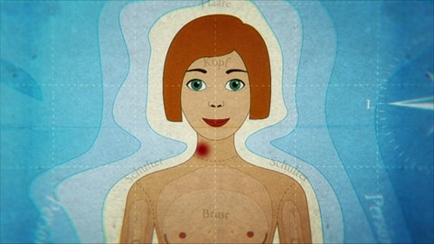 Animiert – Ein Mädchen mit einem Knutschfleck am Hals.