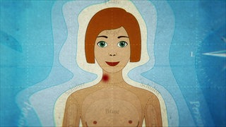 Animiert – Ein Mädchen mit einem Knutschfleck am Hals. 