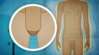 Animiert – Ein nackter Körper, daneben der Penis mit Vorhaut. 