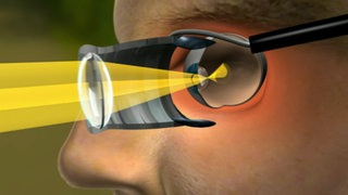 Wie vergrößert eine Lupe? · Frage trifft Antwort