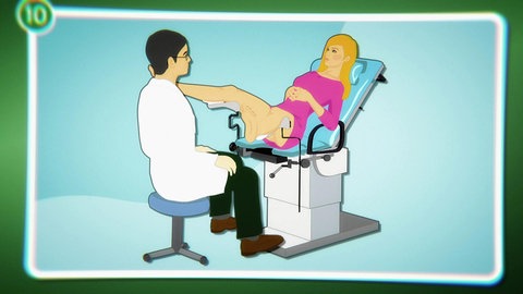 Animiert – Eine Frau sitzt auf einem Stuhl zur Untersuchung vor dem Frauenarzt.