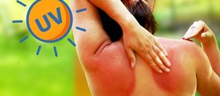 Frau von hinten, fasst sich an den Sonnenbrand am Rücken. Warum müssen wir unsere Haut schützen?